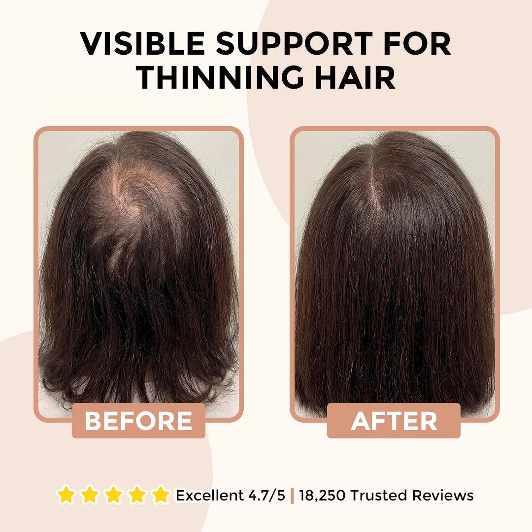 Athena™ Root Revival Shampoo